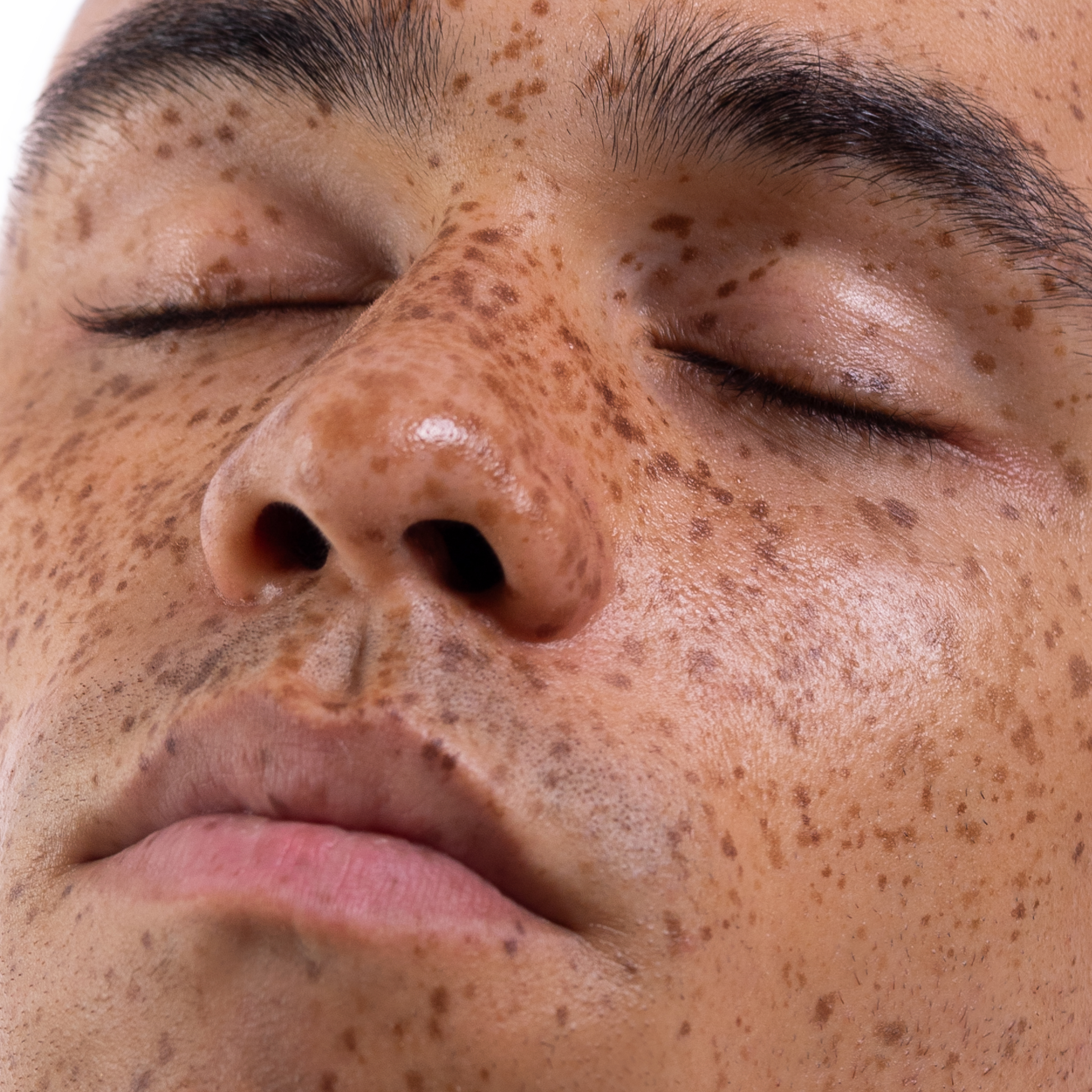Man Showcasing Skin
